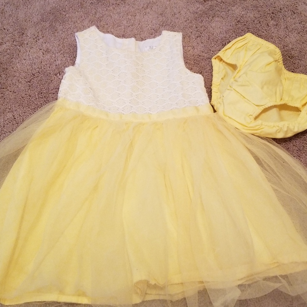 Beautiful yellow dress with lace detail